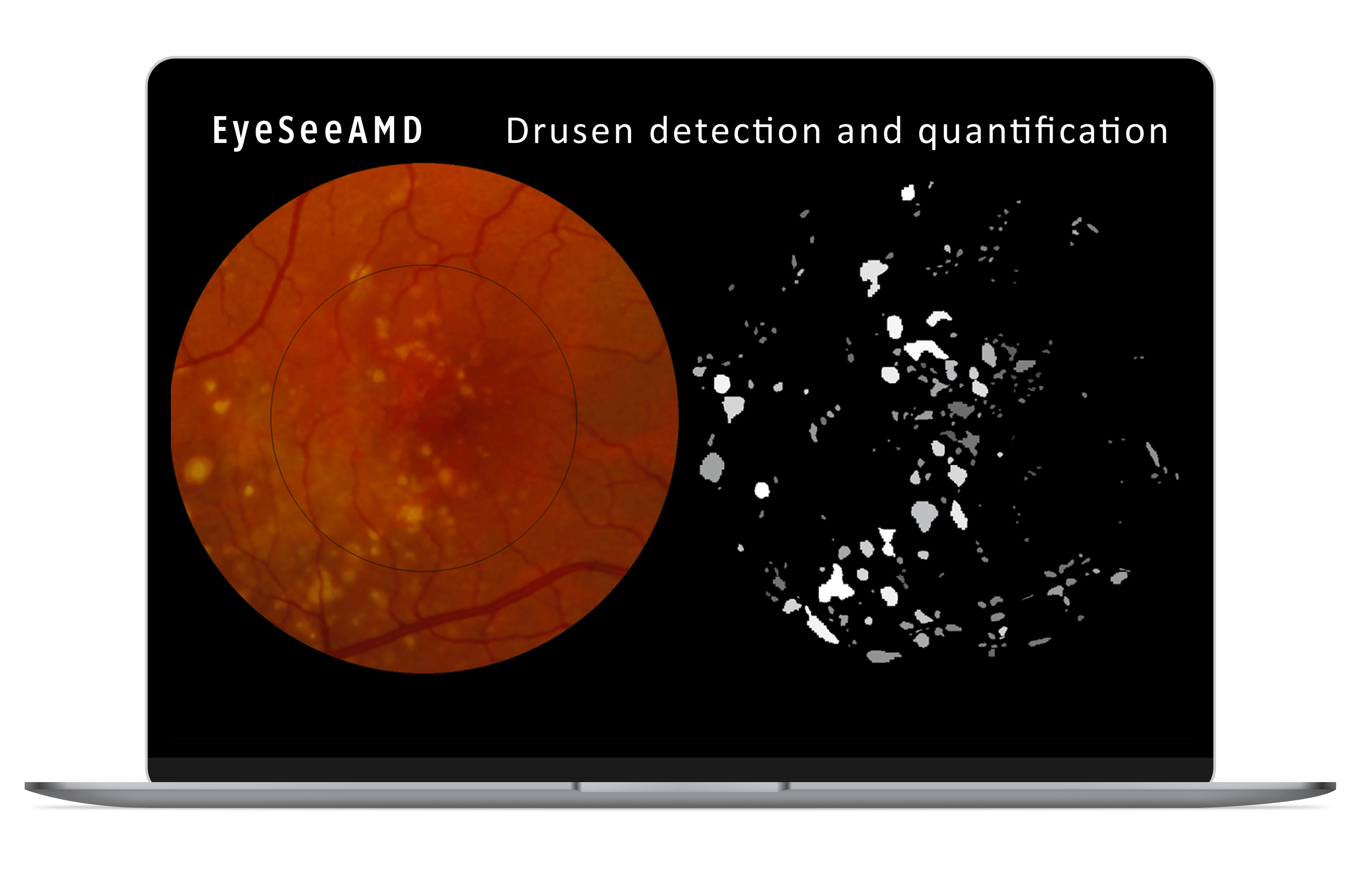 EyeSeeAMD_Macbook_mocup EyeSeeAMD_Macbook_mocup