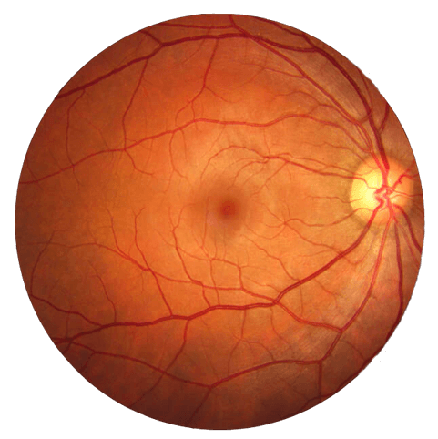 FundusImage Fundus Photography