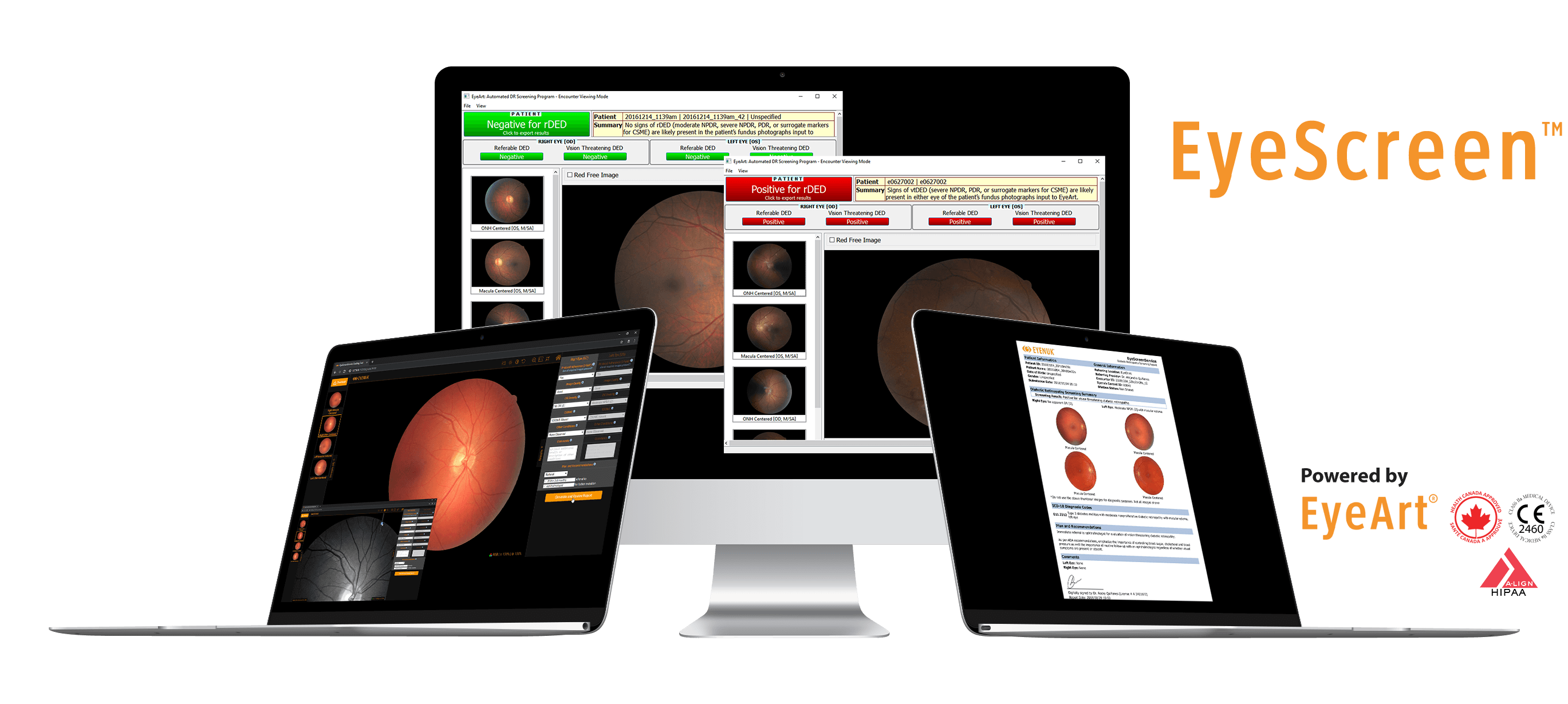 EyeScreenService_Mac_Macbook_Mockups_img_forUS_withTM EyeScreenService_Mac_Macbook_Mockups_img_forUS_withTM