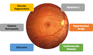 Retina_And_Diseases-cropped Retina_And_Diseases-cropped