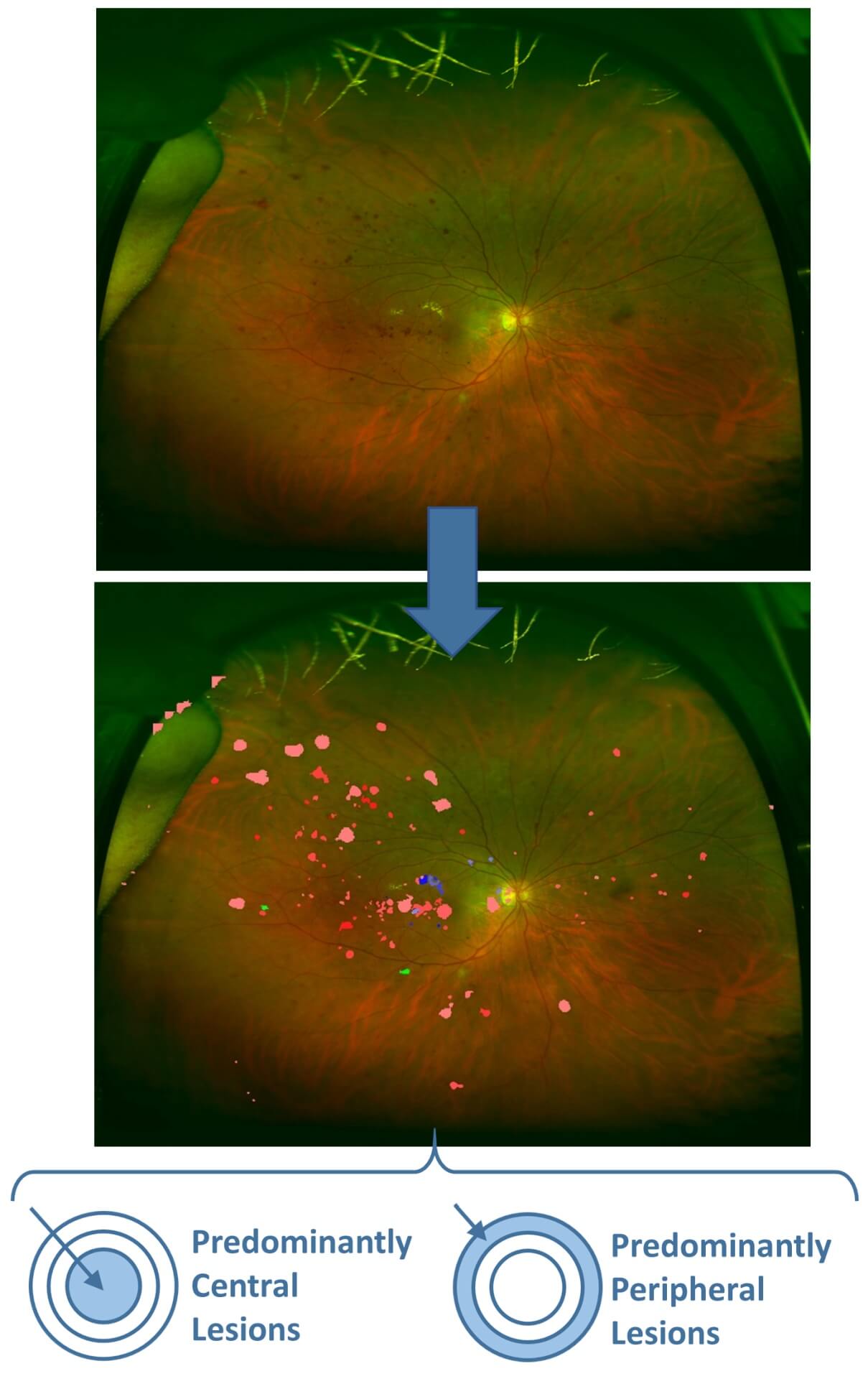 EyeReadUWF-Images-long EyeReadUWF-Images-long