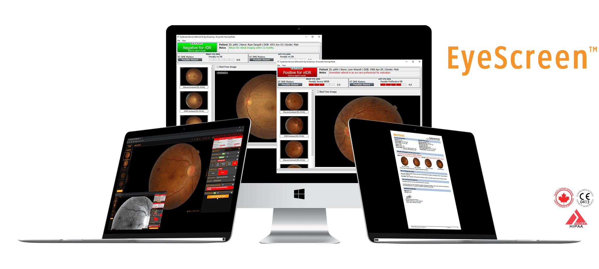 EyeScreenService_Mac_Macbook_Mockups_img_forUS_withTM EyeScreenService_Mac_Macbook_Mockups_img_forUS_withTM